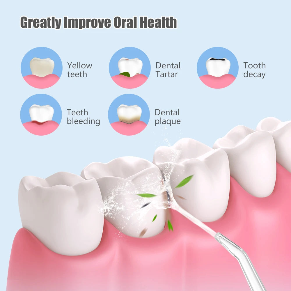 Irrigador Bucal Portátil con Hilo Dental de Agua Recargable por USB - Limpieza Dental Profunda y Cuidado Oral Avanzado