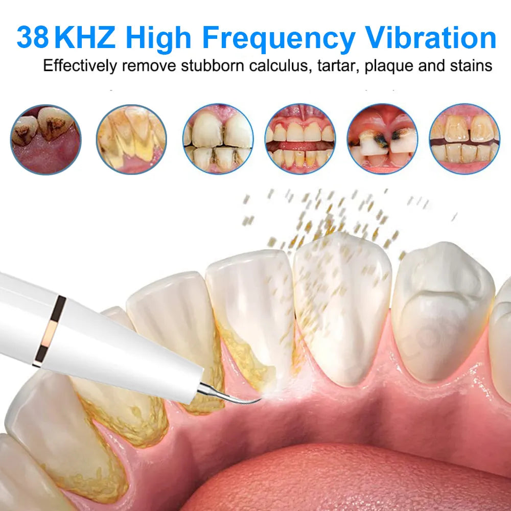 Electric Ultrasonic Dental Tartar Scaler for Deep Cleaning and Complete Oral Care