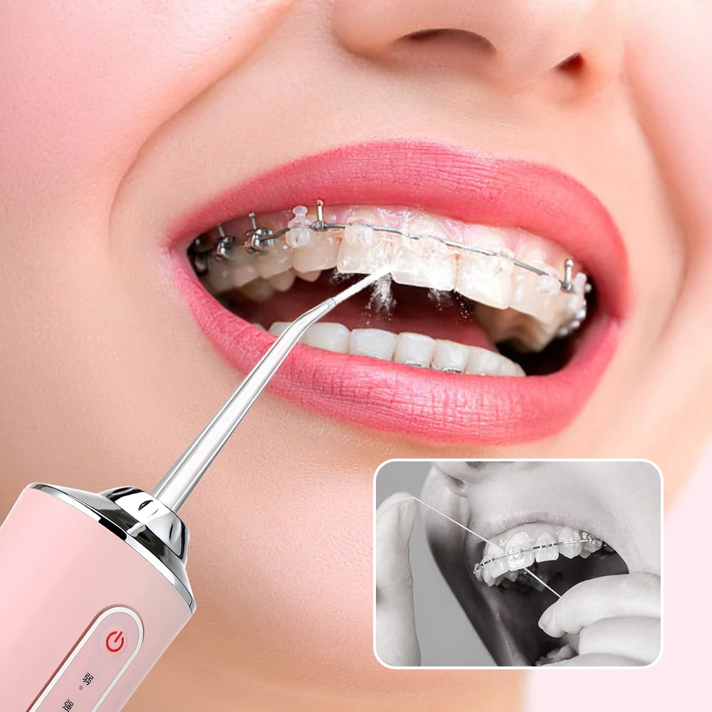 Irrigador Bucal Portátil con Hilo Dental de Agua Recargable por USB - Limpieza Dental Profunda y Cuidado Oral Avanzado